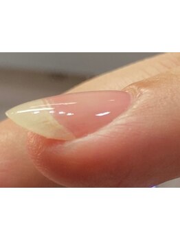 爪の悩みを解消できる（ケア含む）