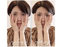 GINZA美容整体 コアのミ/人気のビフォーアフター★