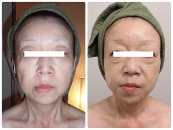 グレイスボディ ヨークタウン坂東店(Grace Body)/小顔フェイシャル