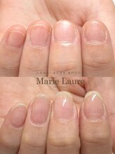 マリーロール 淀屋橋本店(Marie Laure)/自爪育成/深爪矯正/ネイルケア