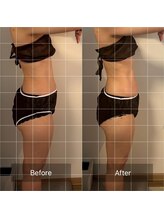 フィエルテ 甲斐敷島(FIERTE)/お客様 Before After