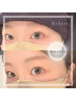 アリゼ(Alize)/ラッシュリフト