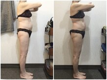 美容整体ウェリナ あま甚目寺院/小顔矯正/骨盤矯正/美脚サロン