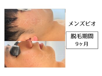 メンズビオ 神戸三宮店/