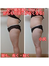 ヨサパーク アエル(YOSA PARK AELL)/よもぎ蒸し/痩身/反り腰/下半身