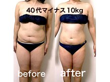 エステサロンクオーツの雰囲気（プライベート女性専用サロンだからこそ、安心してご相談ください）