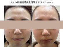 オリエンス(oriens)の雰囲気（毎月の小顔作り継続でこんなに変化！大満足のお声多数！）