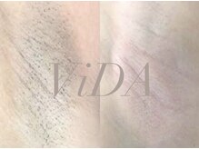 ヴィーダ 渋谷松濤(ViDA)の雰囲気（完全都度払い制/1パーツ￥3,300～【Before Afterフォト掲載中】）