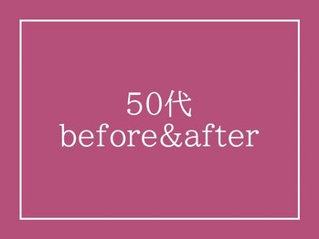 アクアビー(AQUA-B)/