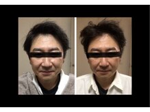 マシュマロヘッド 目黒店(Mashumaro Head)/ヘッドスパでエイジングケアを☆