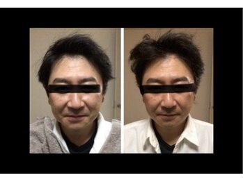 マシュマロヘッド 目黒店(Mashumaro Head)/ヘッドスパでエイジングケアを☆