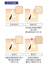 ジェンヌ(jenne.)/毛穴を見極めます