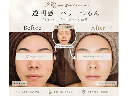 モンスリール 麻布十番(Mon Sourire)の写真