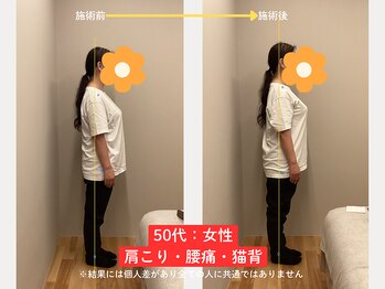 ソルム(solmu)/