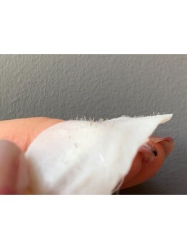 顔脱毛がしたい