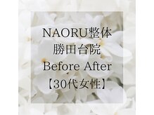 ナオル整体 勝田台院(NAORU整体)/施術事例【30代女性】猫背