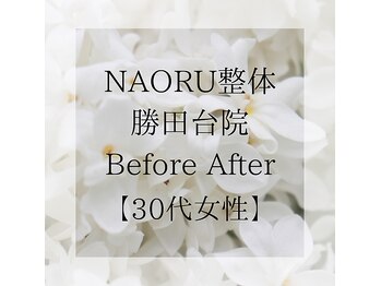 ナオル整体 勝田台院(NAORU整体)/施術事例【30代女性】猫背