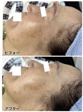 アンジェーム(angeame)/