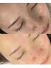 2番人気【毛穴詰まり.産毛ゼロツヤup】毛穴ケア&フェイシャルwax25000→18000