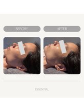 エッセンシャル 南海難波店(ESSENTIAL)/光フォト¥7,000/なんば