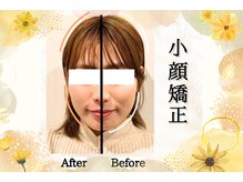 ハニー(honey)/小顔矯正で肩こりも♪