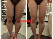 マールム(MALUM)の雰囲気（今から本気出し全身を痩身！短期集中ケアを全面バックアップ！）