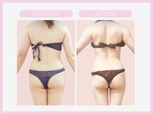 スリムライン 八戸店(The Slim Line)/before→after