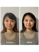 ラリマール/お客様ビフォーアフター