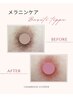 メラニンケア《乳輪・乳頭》¥62000→¥49000
