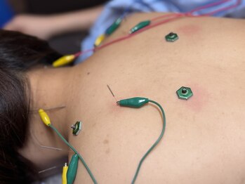 わきさか鍼灸整骨院・鍼灸院 レーヴ(Reve)/