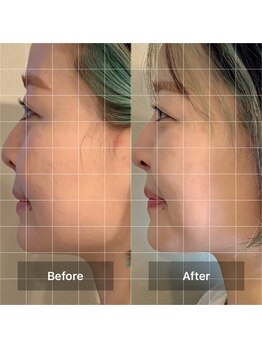 ミームスパ 梅田中崎町(Meem Spa)/【龍の手ヘッドスパ】