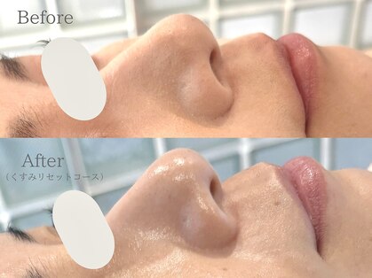 ユイット(huit)の写真