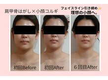 ルル(Ruru)の雰囲気（回数を重ねるごとに、戻りにくい理想の小顔へ。）