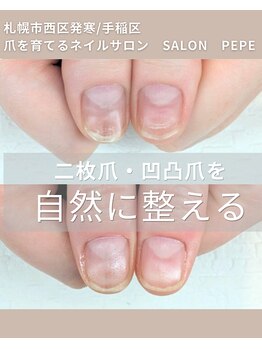 サロンペペ(salon pepe)の写真/諦めかけていたネイルも自爪育成の『salon pepe』で自信の持てる指先へ♪
