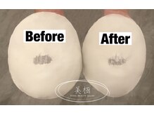 美極 トータルビューティー(美極 TOTAL BEAUTY)/恵比寿/小顔コルギ/エステ/