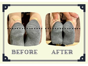 整体院プリュ/Before→ After［22］