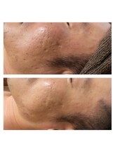 ホズリル(Hozril)/メンズエステ★