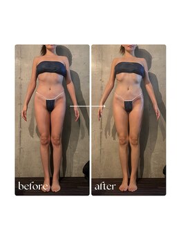 ボーレーヴ 表参道店(beaureve)/痩身/インディバ/ブライダル