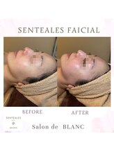 サロン ド ブラン アオヤマ(Salon de BLANC AOYAMA)/SENTEALESフェイシャル