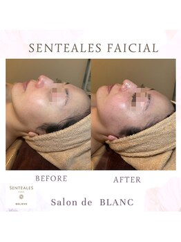 サロン ド ブラン アオヤマ(Salon de BLANC AOYAMA)/SENTEALESフェイシャル