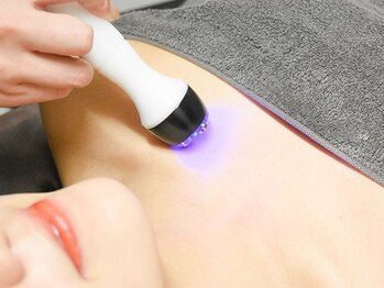 アイラビューティ エステ 中目黒(ISLA BEAUTY)の写真/高周波によって短時間で深層部まで温め脂肪燃焼！強力リフトアップで最強小顔に★施術後の変化に驚くはず♪