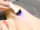 アイラビューティ エステ 中目黒(ISLA BEAUTY)の写真/高周波によって短時間で深層部まで温め脂肪燃焼！強力リフトアップで最強小顔に★施術後の変化に驚くはず♪