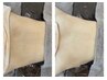 【背中ハーブピーリング】背中のニキビ/黒ずみ改善、ザラつきの方にも◎