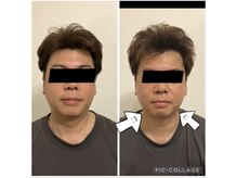 ひかり整体 リラクゼーションの雰囲気(小顔マッサージは男女問わず人気!オプションで選べます!)