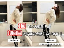 なかもず 輝き美容整体院/腰痛改善