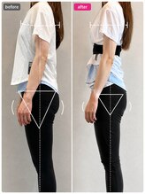 ホリック アイス コア ボディ(HOLIC ICE CORE BODY)/お客様のビフォーアフター11