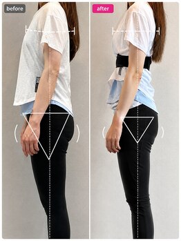 ホリック アイス コア ボディ(HOLIC ICE CORE BODY)/お客様のビフォーアフター11