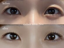 ネア(Nea)