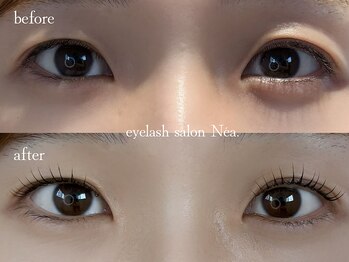 ネア(Nea)の写真/結婚式前に上品さを入れつつ華やかなデザインに