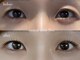 ネア(Nea)の写真/結婚式前に上品さを入れつつ華やかなデザインに